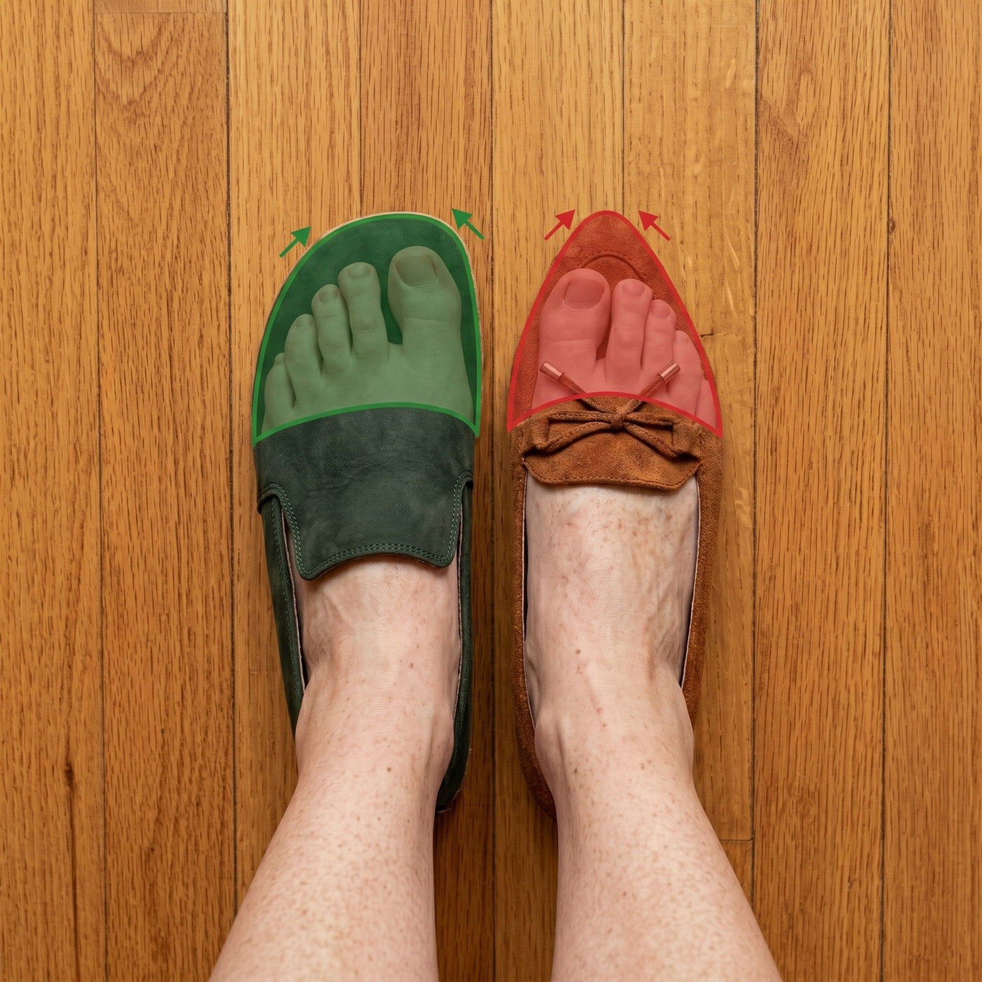 Foot-shape comparison — anatomic vs tapered toe box