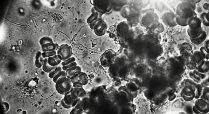 Heightened Thermal Activity