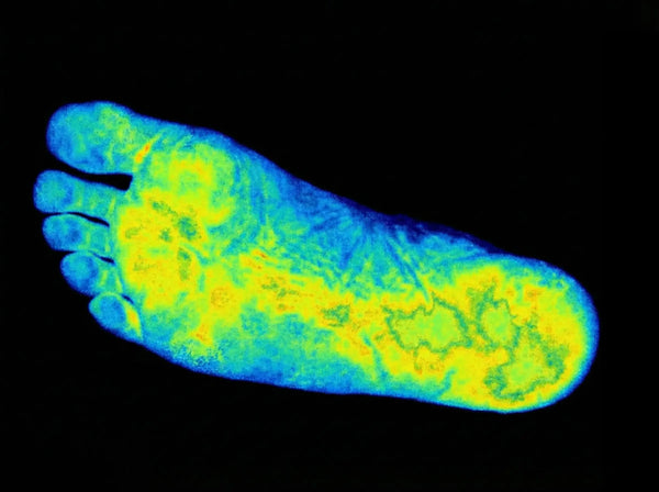 After Grounding - Foot