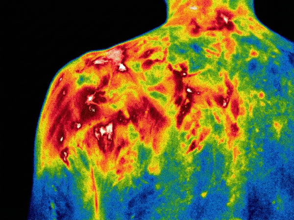 Before Grounding - Shoulder
