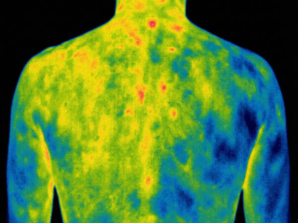After Grounding - Upper